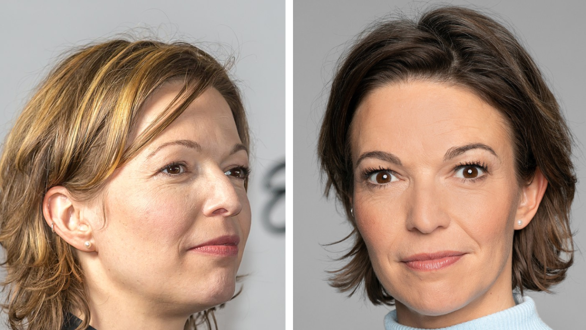 Anna Planken Krebserkrankung – Fakten und Hintergründe